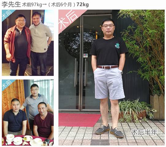 国际瘦身趋势最新动态更新