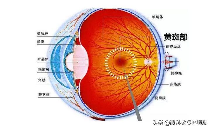 视网膜色素变性最新进展与小巷中的隐秘宝藏探索